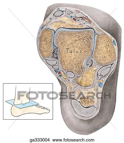 Transverse section and MRI through ankle. A. Transverse section. Insert image indicates level of dissection. View Large Illustration Stock Illustration - Transverse section and MRI through ankle. A. Transverse section. Insert image indicates level of dissection.. Fotosearch