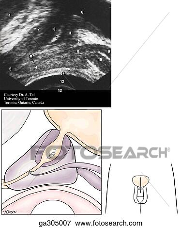 Stock Illustration - Transverse section and ultrasound of male pelvis.. Fotosearch
