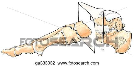 Drawing - Transverse tarsal joint. A. Bones of foot, medial view.. Fotosearch