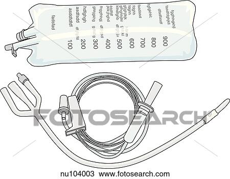 A three way Foley catheter with a triple lumen to remove urine from bladder and to administrate medication or irrigation fluid. View Large Illustration Drawing - A three way Foley catheter with a triple lumen to remove urine from bladder and to administrate medication or irrigation fluid.. Fotosearch