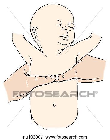 Stock Illustration -  adult hands administering CPR to tiny baby with thumbs placed on chest.. Fotosearch