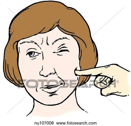 Stock Illustration - Anterior view of female patient with hand of nurse illiciting a positive Chovstek sign by tapping the cheek over the facial nerve which causes patient's lip to twitch.. Fotosearch