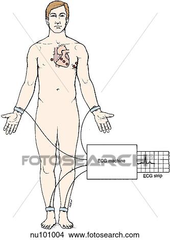 Stock Illustration - Anterior view of man attached to ECG machine by wrists and ankles. Transmission of heart's impulse is displayed on an ECG strip. Heart is visible with points for conducting electrical activity on the chest pericardium indicated.. Fotosearch