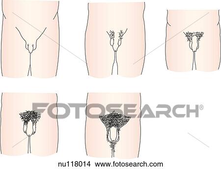 Anterior Views Of Male Pubic Hair Development Top Left Rating 1