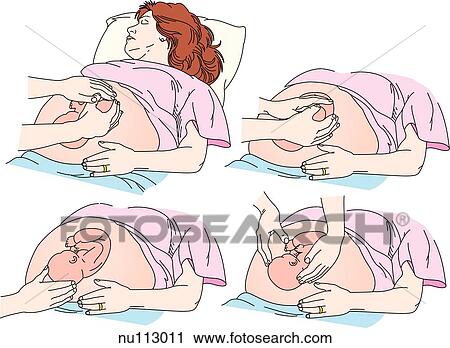 Clip Art - Anterolateral view of a health care worker performing the Leopold maneuvers on a pregnant woman and fetus. The purpose is to systematically observe and palpate the abdomen to determine fetal presentation and position.. Fotosearch