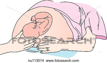 Anterolateral view of a health care worker performing the third Leopold maneuver on a pregnant woman and fetus. This step determines the part of the fetus at the inlet and its mobility. View Large Illustration Stock Illustration - Anterolateral view of a health care worker performing the third Leopold maneuver on a pregnant woman and fetus. This step determines the part of the fetus at the inlet and its mobility.. Fotosearch
