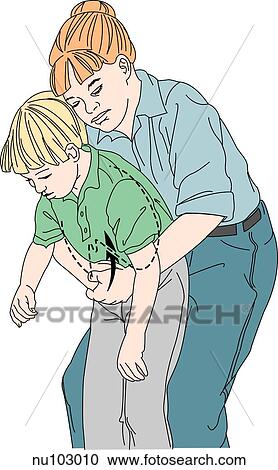 Anterolateral view showing an adult female performing the Heimlich maneuver on a school age child. Ribcage of child is outlined in a dashed line. View Large Illustration Clipart - Anterolateral view showing an adult female performing the Heimlich maneuver on a school age child. Ribcage of child is outlined in a dashed line. . Fotosearch