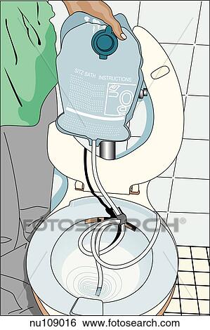 Stock Illustration - Anterosuperior view of a sitz bath set-up used for healing the perineum through the application of moist heat.. Fotosearch