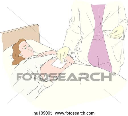 Stock Illustration - Body of nurse shown applying sterile dressing to abdominal wound of female patient.. Fotosearch