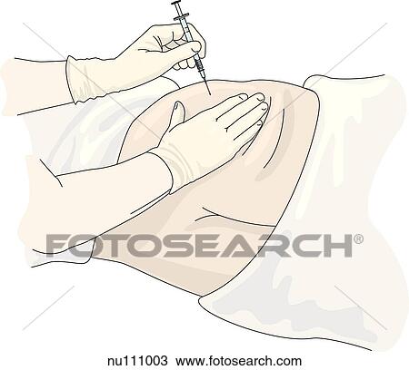 Gloved hands of health care professional administering first stick of injection to dorsogluteal area. View Large Illustration Drawing - Gloved hands of health care professional administering first stick of injection to dorsogluteal area.. Fotosearch