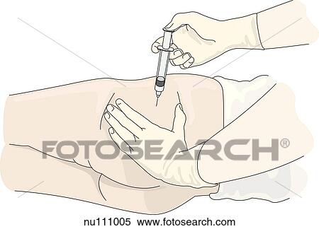 Stock Illustration - Gloved hands of health care professional administering injection to dorsogluteal area.. Fotosearch