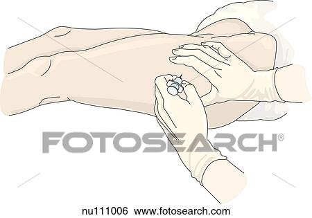 Gloved hands of health care professional removing syringe from dorsogluteal area. Skin is spread around needle entry site with left hand while needle is quickly removed at same angle as inserted with right. View Large Illustration Stock Illustration - Gloved hands of health care professional removing syringe from dorsogluteal area. Skin is spread around needle entry site with left hand while needle is quickly removed at same angle as inserted with right.. Fotosearch