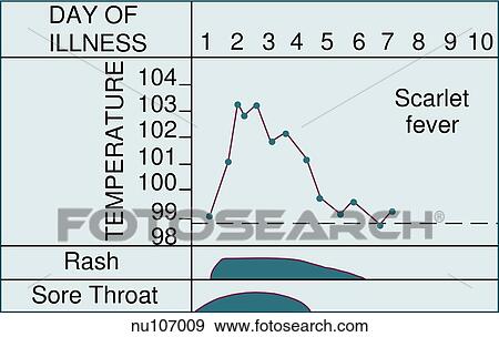 Graphic demonstrating the various characteristics of exanthem subitum, an acute exanthem characterized by rash. View Large Illustration Stock Illustration - Graphic demonstrating the various characteristics of exanthem subitum, an acute exanthem characterized by rash.. Fotosearch