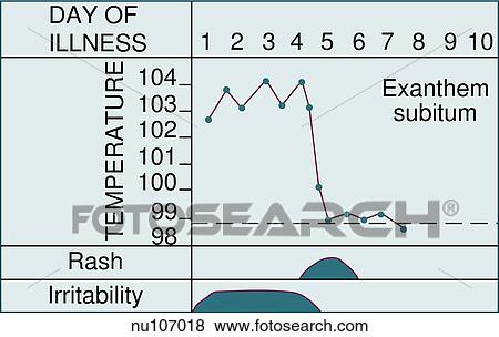 Graphic demonstrating the various characteristics of scarlet fever, an acute exanthem characterized by rash. View Large Illustration Stock Illustration - Graphic demonstrating the various characteristics of scarlet fever, an acute exanthem characterized by rash.. Fotosearch