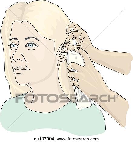 Hands of nurse shown placing tympanic membrane thermometer with probe cover in patient's ear. View Large Illustration Stock Illustration - Hands of nurse shown placing tympanic membrane thermometer with probe cover in patient's ear.. Fotosearch