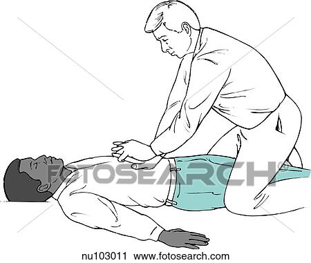 Clip Art - Illustration of man kneeling astride unconscious victim's thighs, his hands in the proper position on the victim's abdomen to perform the Heimlich maneuver.. Fotosearch