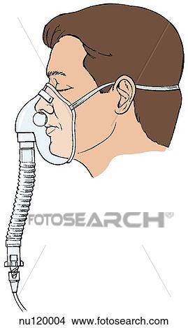 Stock Illustration - Illustration showing a patient wearing a mask with a heated nebulizer.. Fotosearch
