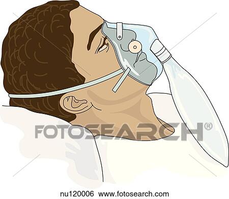 Stock Illustration - Lateral view of head and shoulders of patient wearing a nonrebreather oxygen mask.. Fotosearch