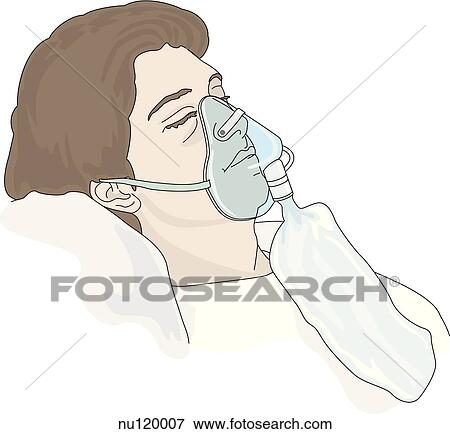 Stock Illustration - Lateral view of head and shoulders of patient wearing a partial rebreather oxygen mask.. Fotosearch