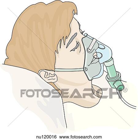 Lateral view of head and shoulders of patient wearing a Venturi oxygen mask. View Large Illustration Stock Illustration - Lateral view of head and shoulders of patient wearing a Venturi oxygen mask.. Fotosearch