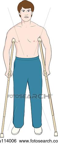 Man demonstrating tripod position for poper crutch stance. View Large Illustration Stock Illustration - Man demonstrating tripod position for poper crutch stance.. Fotosearch