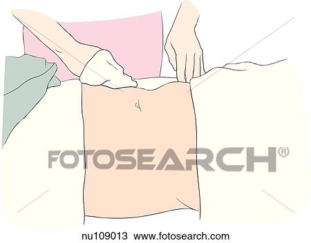 nurse from waist down washing abdomen of patient with perineal and chest areas covered. View Large Illustration Drawing - nurse from waist down washing abdomen of patient with perineal and chest areas covered.. Fotosearch