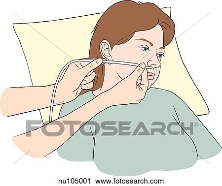 Clip Art - Nurse's hands visible near patient's face measuring distance from nostril to tip of earlobe with tubing.. Fotosearch