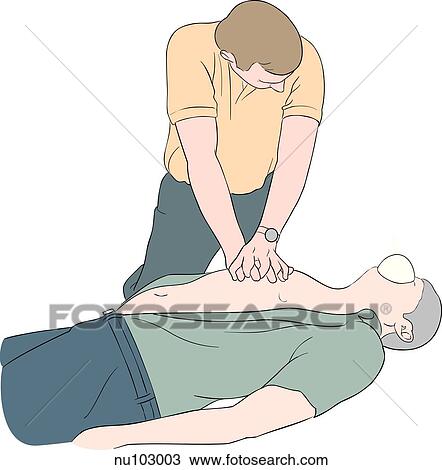 One man performing chest compressions on a prone male. View Large Illustration Drawing - One man performing chest compressions on a prone male.. Fotosearch