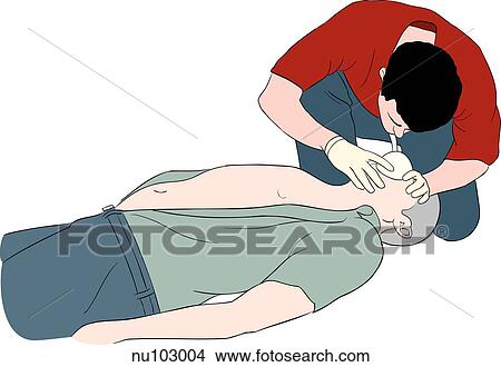 One man performing rescue breathing (through a protective mask) on prone male. View Large Illustration Stock Illustration - One man performing rescue breathing (through a protective mask) on prone male.. Fotosearch