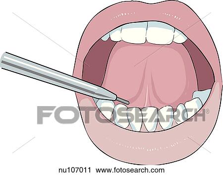 open mouth with tongue raised as mercury thermometer is placed in right sublingual pocket. View Large Illustration Clip Art - open mouth with tongue raised as mercury thermometer is placed in right sublingual pocket.. Fotosearch