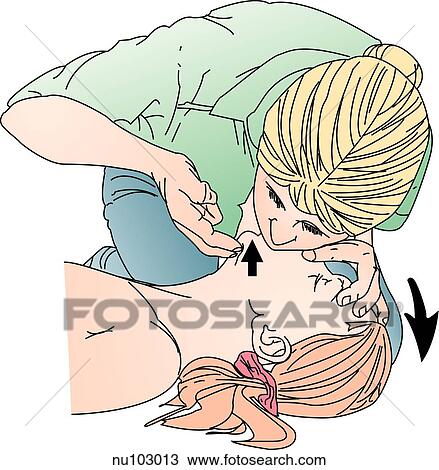 Rescue breathing in child. Rescuer's mouth covers mouth of child. One hand maintains head tilt; thumb and forefinger of same hand pinches child's nose. Other hand lifts child's jaw. View Large Illustration Drawing - Rescue breathing in child. Rescuer's mouth covers mouth of child. One hand maintains head tilt; thumb and forefinger of same hand pinches child's nose. Other hand lifts child's jaw.. Fotosearch