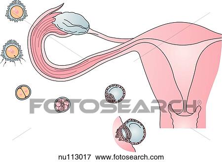 Schema of ovulation, fertilization and implantation. Coronal view of uterus, uterine (Fallopian) tubes, and ovary is shown. At time of implantation, blastocyst is already differentiated into germ layers (ectoderm, mesoderm, and entoderm). Trophoblast ce View Large Illustration Stock Illustration - Schema of ovulation, fertilization and implantation. Coronal view of uterus, uterine (Fallopian) tubes, and ovary is shown. At time of implantation, blastocyst is already differentiated into germ layers (ectoderm, mesoderm, and entoderm). Trophoblast ce. Fotosearch