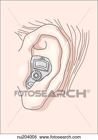 横の視野 の 左 耳 で 補聴器 位置を定められた 中に 外耳 の Ear イラスト Nu4005 Fotosearch