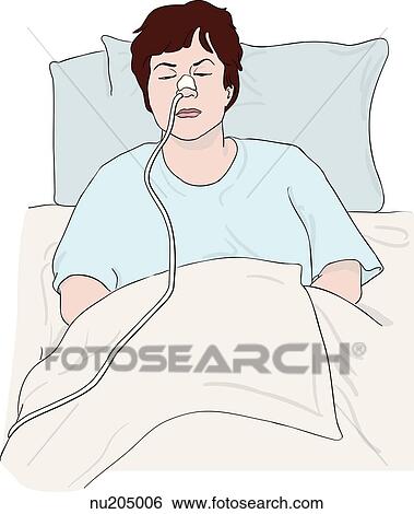 Stock Illustration - Female patient slightly elevated in hospital bed with nasogastric tube in place.. Fotosearch