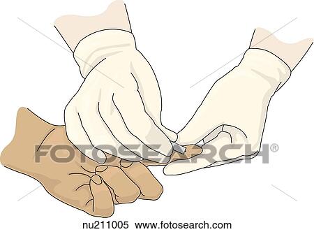 Stock Illustration - Gloved hands of health care professional using a lancet to prick index finger.. Fotosearch