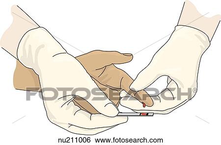 Gloved hands of health care professional hold patient's finger over test strip to place drop of blood onto target area. View Large Illustration Stock Illustration - Gloved hands of health care professional hold patient's finger over test strip to place drop of blood onto target area.. Fotosearch