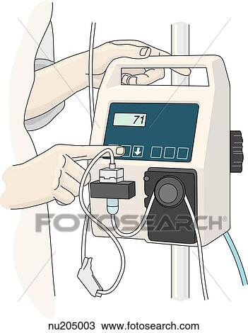 Hands of nurse setting rate and volume of feeding on pump. View Large Illustration Drawing - Hands of nurse setting rate and volume of feeding on pump.. Fotosearch
