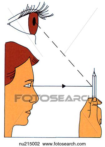 Illustration showing normal pupil contricting when focused on a close object. View Large Illustration Drawing - Illustration showing normal pupil contricting when focused on a close object.. Fotosearch