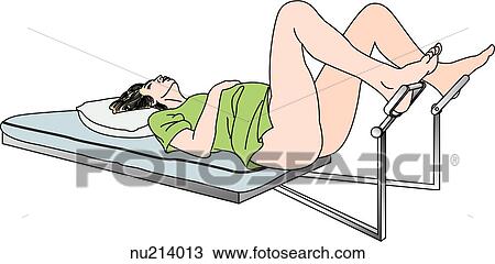 Inferolateral view of a woman on a table with her feet in the stirrups in the lithotomy position used for a pelvic examination. The patient's buttocks should be just over the edge of the table. View Large Illustration Drawing - Inferolateral view of a woman on a table with her feet in the stirrups in the lithotomy position used for a pelvic examination. The patient's buttocks should be just over the edge of the table.. Fotosearch