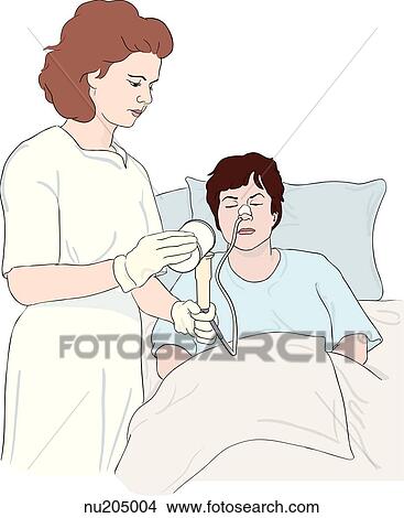 Nurse adding feeding to syringe of female patient's nasogastric tube. View Large Illustration Stock Illustration - Nurse adding feeding to syringe of female patient's nasogastric tube.. Fotosearch