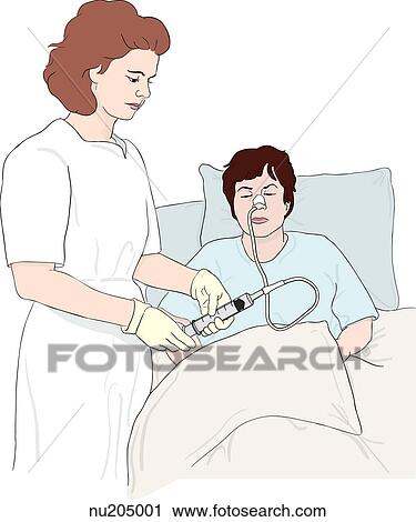 Clip Art - Nurse aspirating stomach fluids into syringe of female patient's nasogastric feeding tube.. Fotosearch