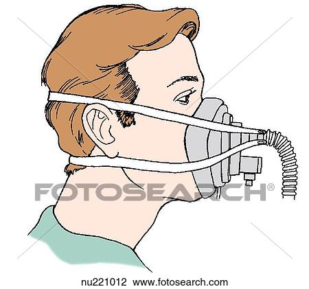 Patient being administered oxygen by a face mask with continuous positive airway pressure (CPAP). View Large Illustration Drawing - Patient being administered oxygen by a face mask with continuous positive airway pressure (CPAP).. Fotosearch