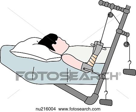 Stock Illustration - Principle Dunlop's (skeletal) traction. The elbow is pulled lateral by a weight connected to a pin inserted into the elbow. Traction is then applied to the wrist by a second set of weight as seen in the image.. Fotosearch