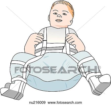 Stock Illustration - Toddler with a Pavlik harness to correct a hip defect. It holds the hips flexed, abducted, and externally rotated. . Fotosearch