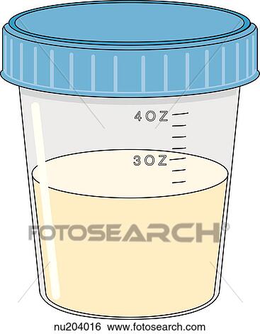 Urine specimen cup with contents. View Large Illustration Stock Illustration - Urine specimen cup with contents.. Fotosearch