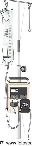 Stock Illustration - Feeding pump with feeding bag in place.. Fotosearch