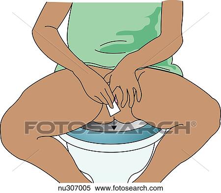 Illustration demonstrates the second step when obtaining clean catch specimen. The female client cleanses her peritoneum, washing from front to back, using a cotton ball or wipe in only one stroke and then discarding it. View Large Illustration Stock Illustration - Illustration demonstrates the second step when obtaining clean catch specimen. The female client cleanses her peritoneum, washing from front to back, using a cotton ball or wipe in only one stroke and then discarding it.. Fotosearch