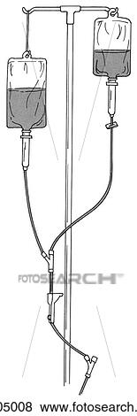 Stock Illustration - Illustration demonstrating a piggyback setup for intermittent delivery of IV medications.. Fotosearch