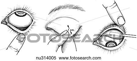Illustration demonstrating.... View Large Illustration Stock Illustration - Illustration demonstrating..... Fotosearch