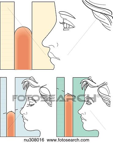 Illustration demonstrating the proper technique for reading blood pressure levels when using a manometer. The top image illustrates the proper technique with eye level equal with meniscus level. The bottom two images show how improper eye level will res View Large Illustration Stock Illustration - Illustration demonstrating the proper technique for reading blood pressure levels when using a manometer. The top image illustrates the proper technique with eye level equal with meniscus level. The bottom two images show how improper eye level will res. Fotosearch